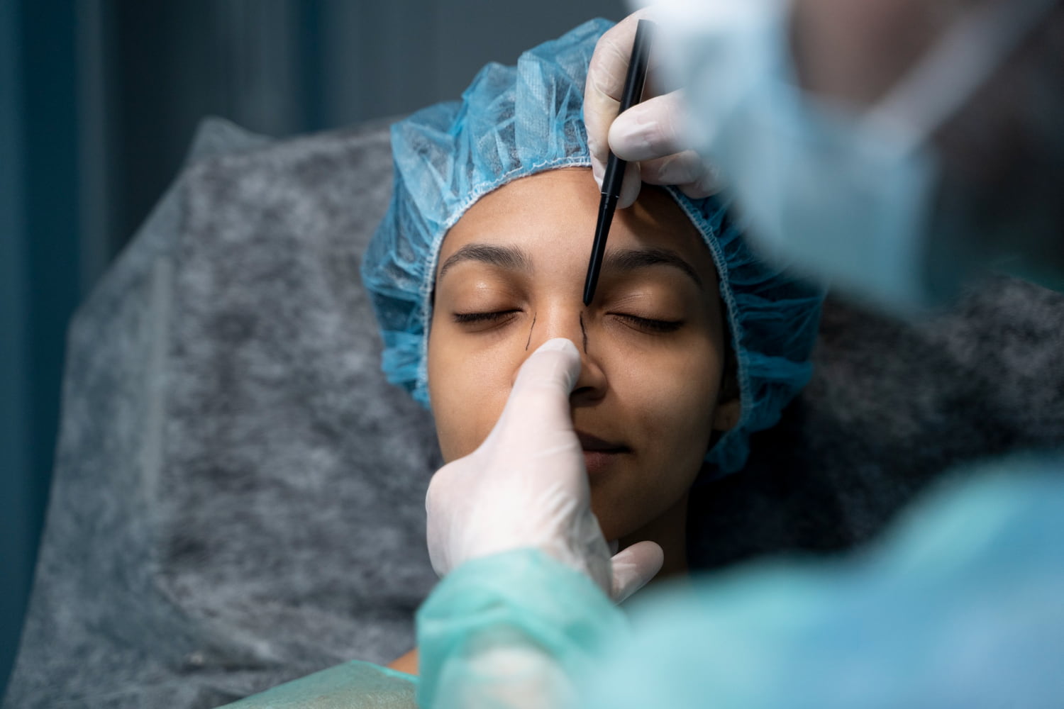 Médico cirurgião marcando nariz de paciente para cirurgia plástica de rinoplastia