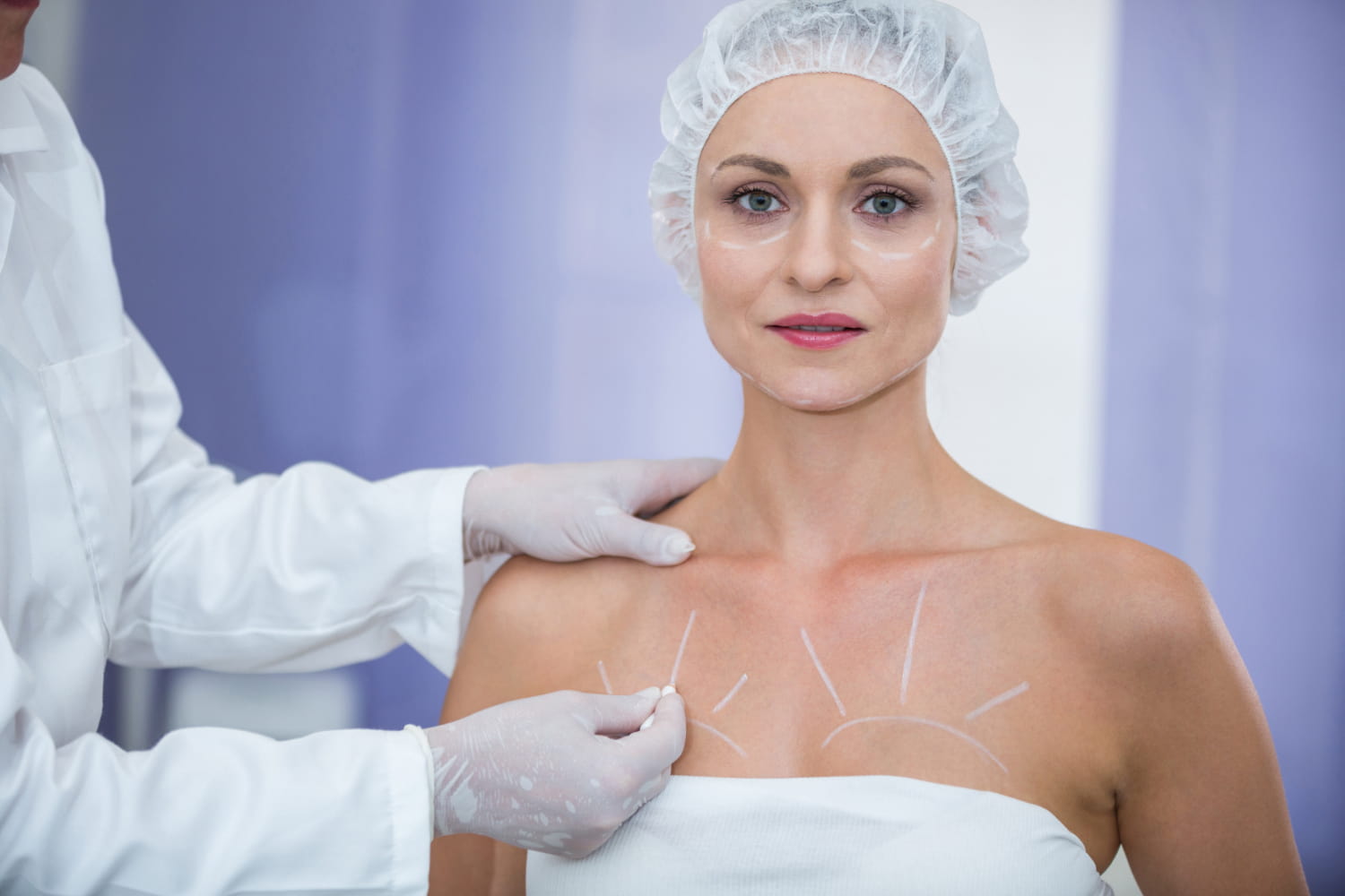 Médico marcando o corpo de paciente do sexo feminino para cirurgia de mamoplastia redutora