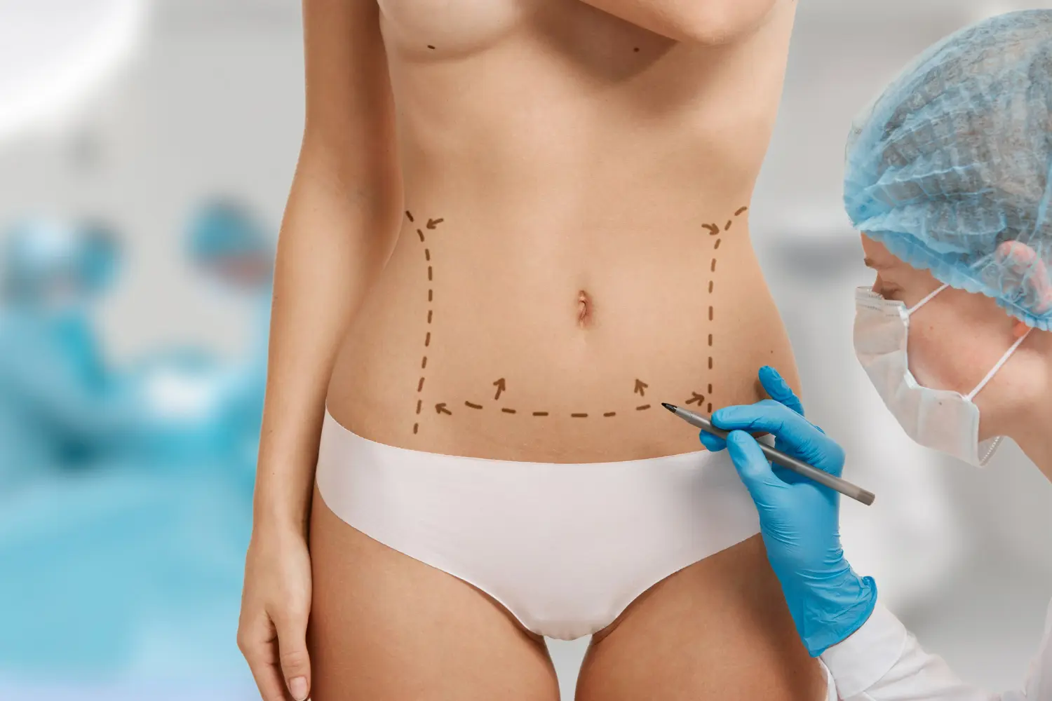 Uma médica cirurgiã prepara paciente para cirurgia de contorno corporal.