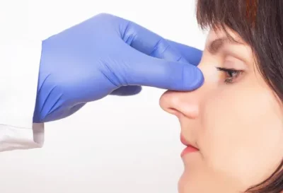 Rinoplastia-640w