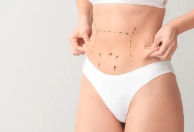 mini_abdominoplastia-1920w